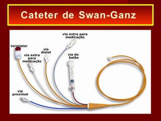 Cateter de Swan-Ganz
 