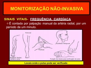 MONITORIZAÇÃO NÃO-INVASIVA
SINAIS VITAIS- FREQUÊNCIA CARDÍACA
❖É contada por palpação manual da artéria radial, por um
período de um minuto.
Locais onde o pulso pode ser verificado
 