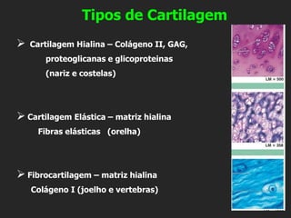 Tipos de Cartilagem
➢ Cartilagem Hialina – Colágeno II, GAG,
proteoglicanas e glicoproteinas
(nariz e costelas)
➢ Cartilagem Elástica – matriz hialina
Fibras elásticas (orelha)
➢ Fibrocartilagem – matriz hialina
Colágeno I (joelho e vertebras)
 