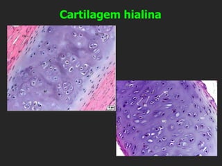 Cartilagem hialina
 