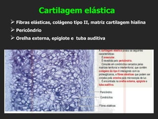 Cartilagem elástica
➢ Fibras elásticas, colágeno tipo II, matriz cartilagem hialina
➢ Pericôndrio
➢ Orelha externa, epiglote e tuba auditiva
 