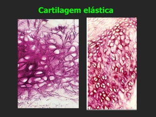 Cartilagem elástica
 