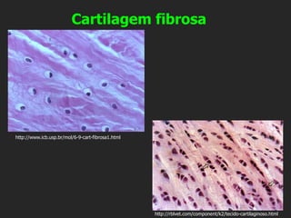 Cartilagem fibrosa
http://www.icb.usp.br/mol/6-9-cart-fibrosa1.html
http://rblvet.com/component/k2/tecido-cartilaginoso.html
 