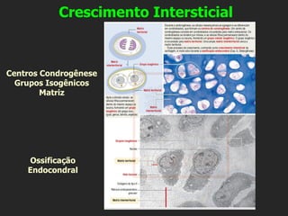 Crescimento Intersticial
Centros Condrogênese
Grupos Isogênicos
Matriz
Ossificação
Endocondral
 