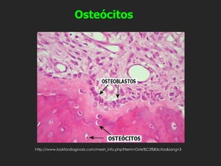 Osteócitos
http://www.lookfordiagnosis.com/mesh_info.php?term=Oste%C3%B3citos&lang=3
 