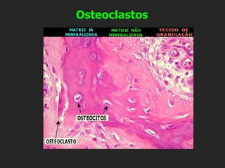 Osteoclastos
 