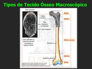 Tipos de Tecido Ósseo Macroscópico
 