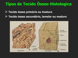 ➢ Tecido ósseo primário ou imaturo
➢ Tecido ósseo secundário, lamelar ou maduro
Tipos de Tecido Ósseo Histologica
 