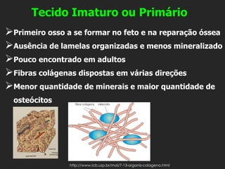 Tecido Imaturo ou Primário
➢Primeiro osso a se formar no feto e na reparação óssea
➢Ausência de lamelas organizadas e menos mineralizado
➢Pouco encontrado em adultos
➢Fibras colágenas dispostas em várias direções
➢Menor quantidade de minerais e maior quantidade de
osteócitos
http://www.icb.usp.br/mol/7-13-organiz-colageno.html
 