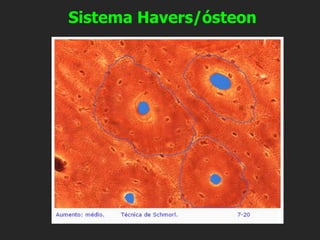 Sistema Havers/ósteon
 