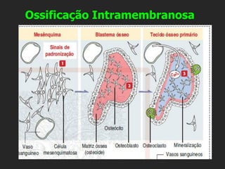 Ossificação Intramembranosa
 