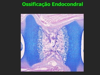 Ossificação Endocondral
 