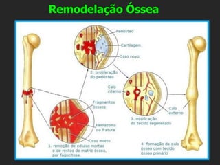Remodelação Óssea
 