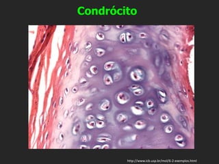 http://www.icb.usp.br/mol/6-2-exemplos.html
Condrócito
 