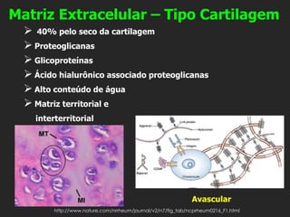 Matriz Extracelular – Tipo Cartilagem
➢ 40% pelo seco da cartilagem
➢ Proteoglicanas
➢ Glicoproteínas
➢ Ácido hialurônico associado proteoglicanas
➢ Alto conteúdo de água
➢ Matriz territorial e
interterritorial
http://www.nature.com/nrrheum/journal/v2/n7/fig_tab/ncprheum0216_F1.html
Avascular
 