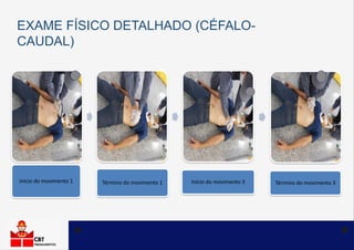 Avalie o abdome
EXAME FÍSICO DETALHADO (CÉFALO-
CAUDAL)
 