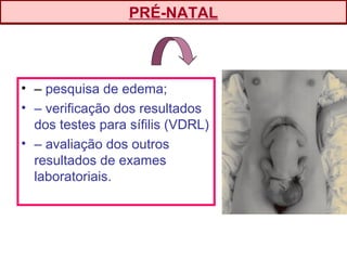 • – pesquisa de edema;
• – verificação dos resultados
dos testes para sífilis (VDRL)
• – avaliação dos outros
resultados de exames
laboratoriais.
PRÉ-NATAL
 