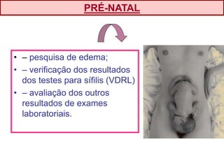 • – pesquisa de edema;
• – verificação dos resultados
dos testes para sífilis (VDRL)
• – avaliação dos outros
resultados de exames
laboratoriais.
PRÉ-NATAL
 