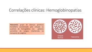 Correlações clínicas: Hemoglobinopatias
Talassemia: grupo de doenças genéticas
hereditária caracterizada pela redução ou
ausência de hemoglobina nos glóbulos
vermelhos do sangue, interferindo no
transporte de oxigênio
 