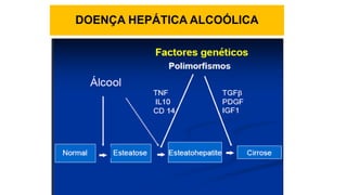DOENÇA HEPÁTICA ALCOÓLICA
 