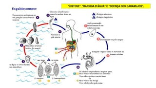 “XISTOSE”, “BARRIGA D’ÁGUA” E “DOENÇA DOS CARAMUJOS”.
 