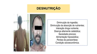 DESNUTRIÇÃO
Diminuição da ingestão;
Diminuição da absorção de nutrientes;
Interação droga nutriente;
Doença altamente catabólica;
Saciedade precoce;
Alimentação hipossódica;
Perdas da paracentese;
Condição sócioeconômica.
 