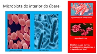 Microbiota do interior do úbere
Staphylococcus aureus,
o Streptococcus agalactiae e
o Mycoplasma bovis
Mycobacterium tuberculosis
Brucella abortus
Lactococcus lactis Lactobacillus
 