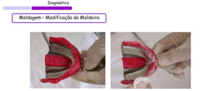 Diagnóstico 
Moldagem – Modificação da Moldeira  