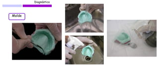 Diagnóstico 
Molde  