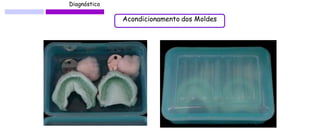 Diagnóstico 
Acondicionamento dos Moldes  