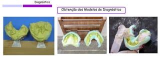 Diagnóstico 
Obtenção dos Modelos de Diagnóstico  
