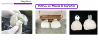 Diagnóstico 
Obtenção dos Modelos de Diagnóstico  