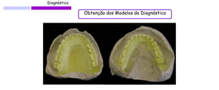 Diagnóstico 
Obtenção dos Modelos de Diagnóstico  