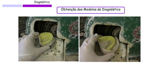 Diagnóstico 
Obtenção dos Modelos de Diagnóstico  