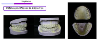 Diagnóstico 
Obtenção dos Modelos de Diagnóstico  