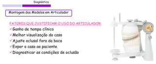 Diagnóstico 
Montagem dos Modelos em Articulador 
Ganho de tempo clínico 
Melhor visualização do caso 
Ajuste oclusal fora da boca 
Expor o caso ao paciente 
Diagnosticar as condições de oclusão 
FATORES QUE JUSTIFICAM O USO DO ARTICULADOR:  