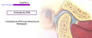Diagnóstico 
Avaliação da ATM 
Avaliação da ATM e dos Músculos da Mastigação  