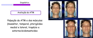 Diagnóstico 
Avaliação da ATM 
Palpação da ATM e dos músculos (masséter, temporal, pterigóideo medial e lateral, trapézio e esternocleidomastoideo  