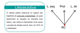 O método gráfico baseia-se no registro das trajetórias de protrusão e lateralidade, as quais determinam os traçados do chamado Arco Gótico, cujo vértice é interpretado como sendo a posição de relação central. Gysi, em 1910, foi o idealizador. 
. 
1. Métodos Gráficos 
RC 
L. esq 
L. dir 
Prot  