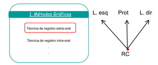 Técnica de registro extra-oral 
Técnica de registro intra-oral 
. 
. 
1. Métodos Gráficos 
RC 
L. esq 
L. dir 
Prot  