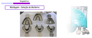 Diagnóstico 
Moldagem – Seleção da Moldeira 
 