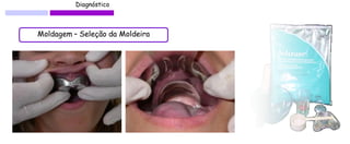 Diagnóstico 
Moldagem – Seleção da Moldeira 
 
