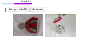 Diagnóstico 
Moldagem – Modificação da Moldeira 
 