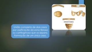 União completa de dois ossos
por ossificação da zona fibrosa
ou cartilaginosa que os separa.
Formação de um único osso.
 