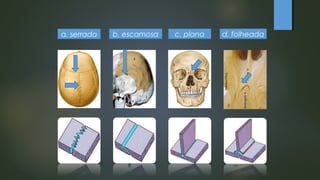 a. serrada b. escamosa c. plana d. folheada
 