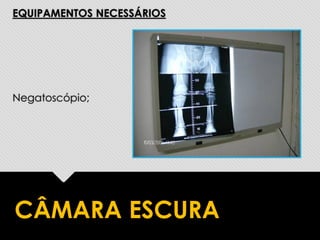 EQUIPAMENTOS NECESSÁRIOS
Negatoscópio;
CÂMARA ESCURA
 