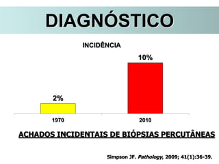 ACHADOS INCIDENTAIS DE BIÓPSIAS PERCUTÂNEAS
DIAGNÓSTICO
Simpson JF. Pathology, 2009; 41(1):36-39.
2%
10%
1970 2010
INCIDÊNCIA
 