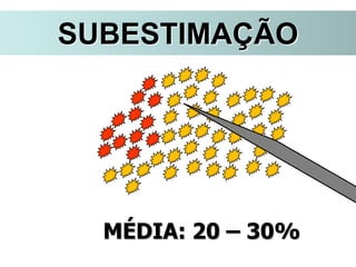 SUBESTIMAÇÃO
MÉDIA: 20 – 30%
 
