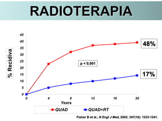 0
5
10
15
20
25
30
35
40
45
0 4 8 12 16 20
%Recidiva
Years
QUAD QUAD+RT
p < 0,001
Fisher B et al., N Engl J Med, 2002; 347(16): 1233-1241.
17%
48%
RADIOTERAPIA
 