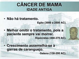 CÂNCER DE MAMA
IDADE ANTIGA
• Não há tratamento.
Egito (3000 a 2500 AC).
• Melhor omitir o tratamento, pois a
paciente sempre vai morrer.
Hipócrates (460-370 AC).
• Crescimento assemelha-se à
garras de caranguejo.
Galeno (130-200 AC).
 